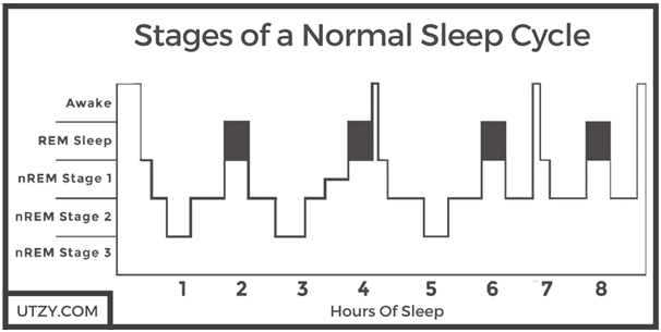 Stages of normal sleep cycle