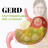 Gerd: Gastroesophageal reflux disease