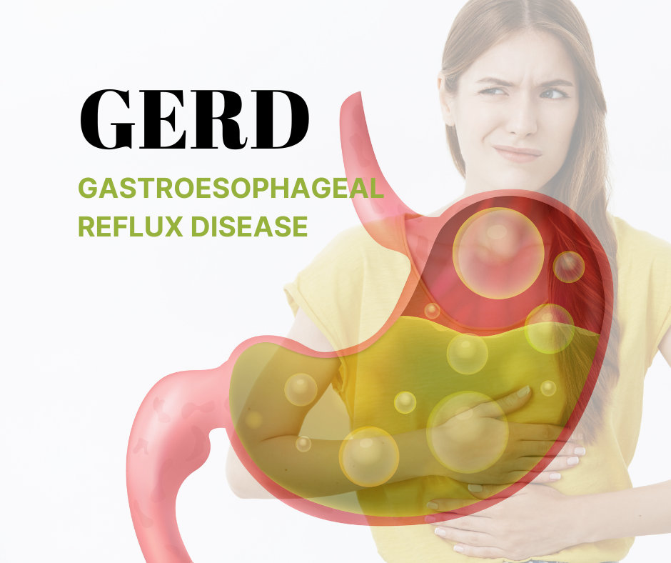 Gerd: Gastroesophageal reflux disease